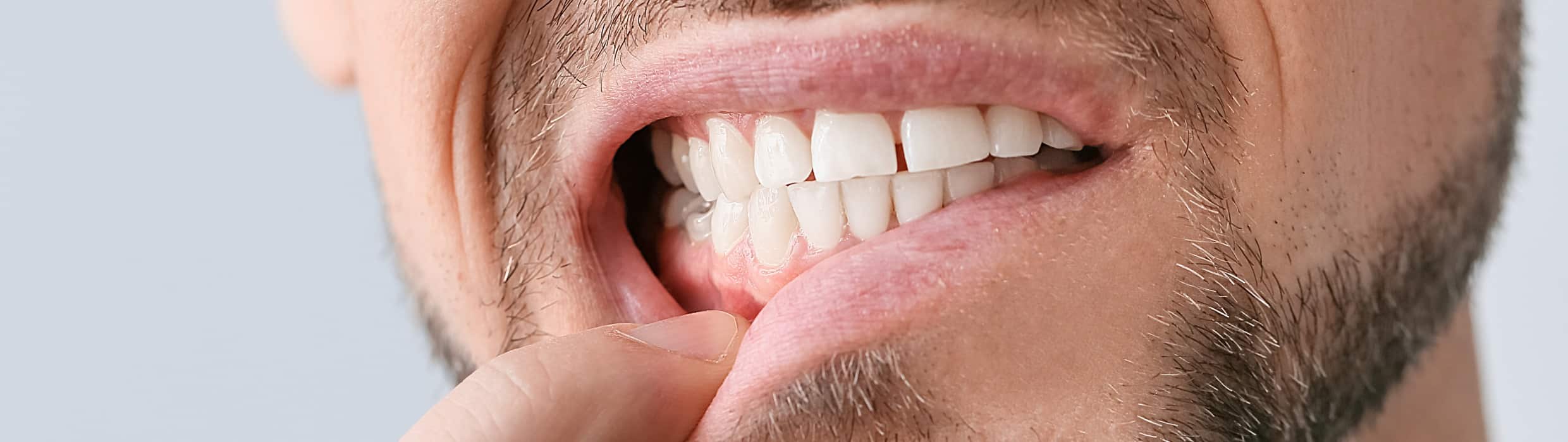Le Dr Sarfati à Paris 16 vous explique les différentes techniques de greffe gingivale
