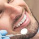 Quels sont les avantages et inconvénients du composite pour embellir les dents ?