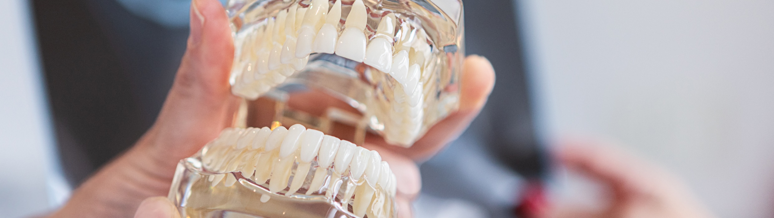 Récession gingivale | Dr Alexandre Sarfati | Paris