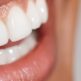 Récession gingivale et sensibilité dentaire : quel lien ?