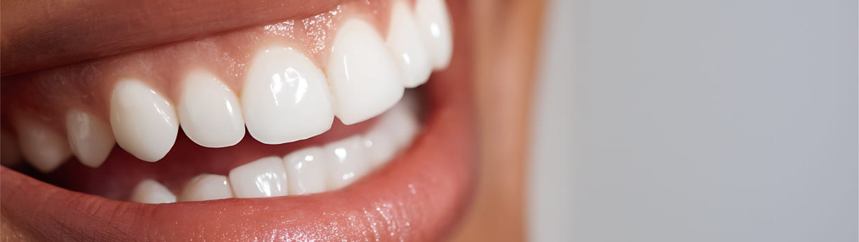 Récession gingivale | Dr Alexandre Sarfati | Paris