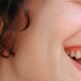 Combien de temps dure un blanchiment dentaire et comment prolonger ses effets ?